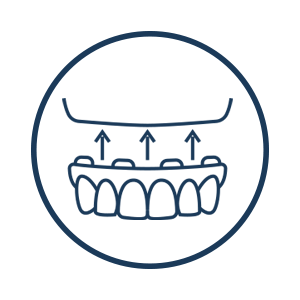 full arch dental implants icon