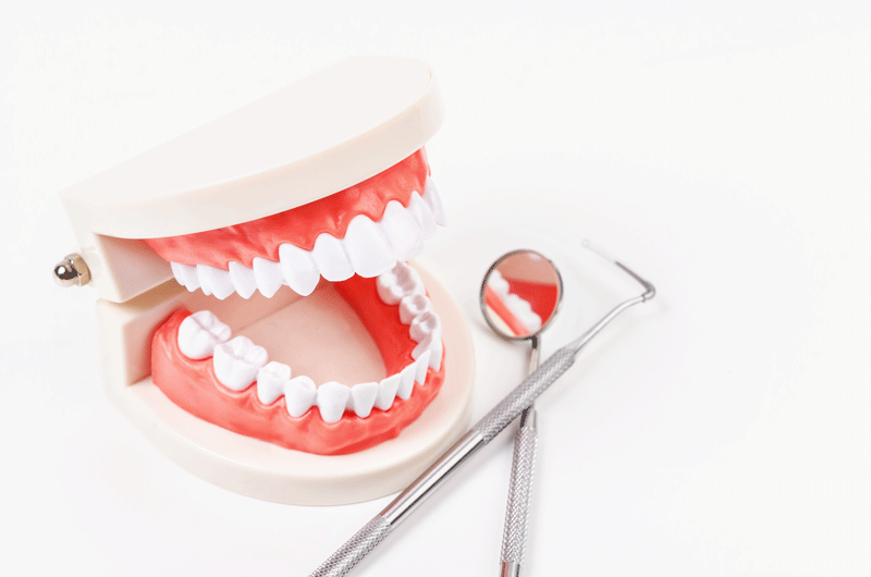 an image of an All-On-4 dental implant model with dental tools next to it.