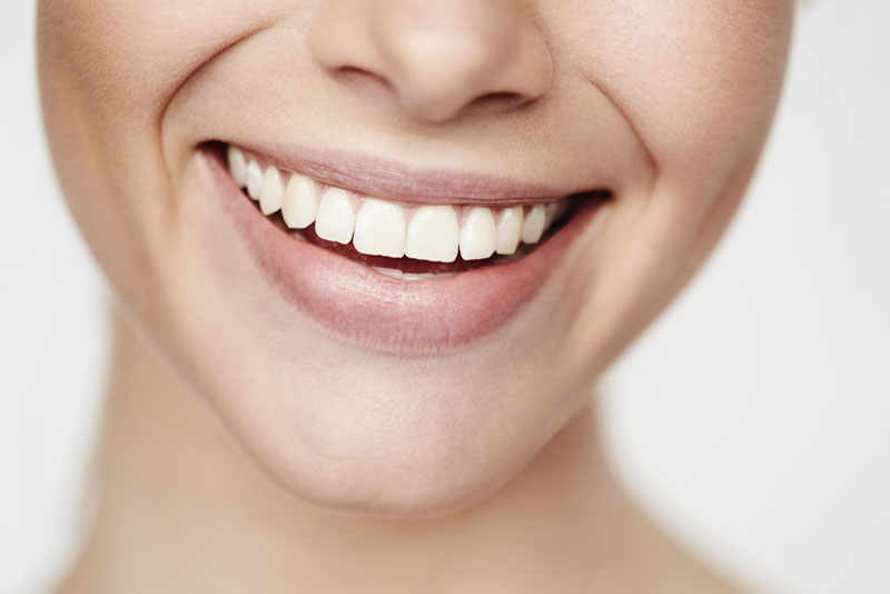 a dental implant patient smiling.