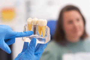 Close-up of dental model with implant. patient of dental clinic on blurred background.