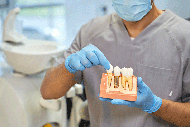 A dental doctor with a model of a dental implant in his hands
